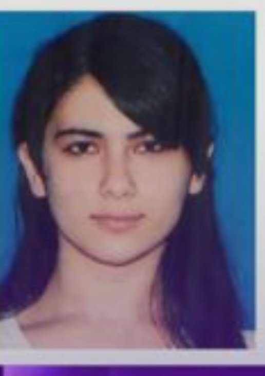 Şəhla Kamilova yaralanan müəllimə