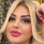 xeste olub